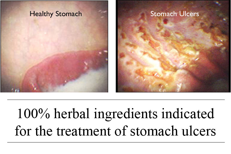 gastriEASE