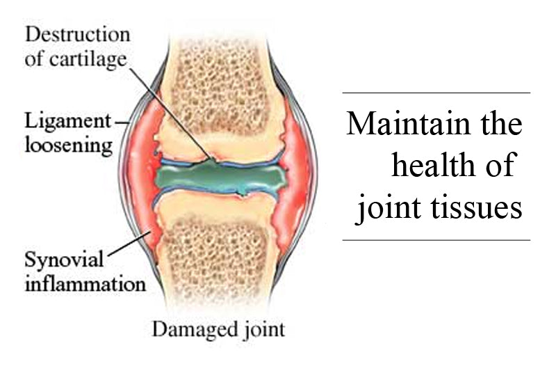 Joint Support